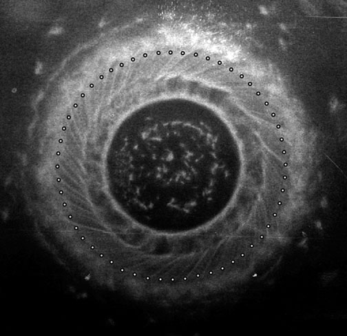 Penumbra – 174 000 Amperes kisülésből kialakult fókuszált sűrű plazma.